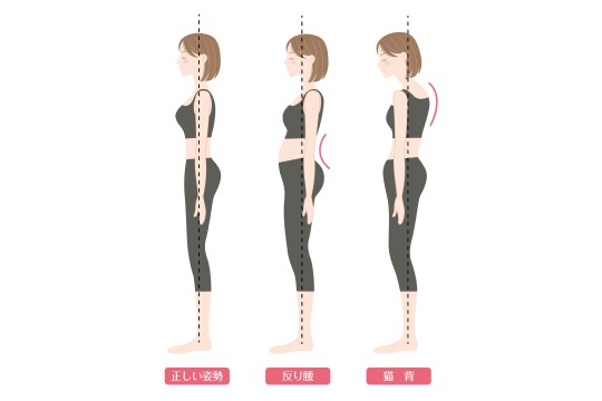 猫背、巻き肩、反り腰